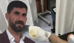 Hızar kazasında iki parmağını kaybetti! Aileden `13 saatlik bekleme` iddiası